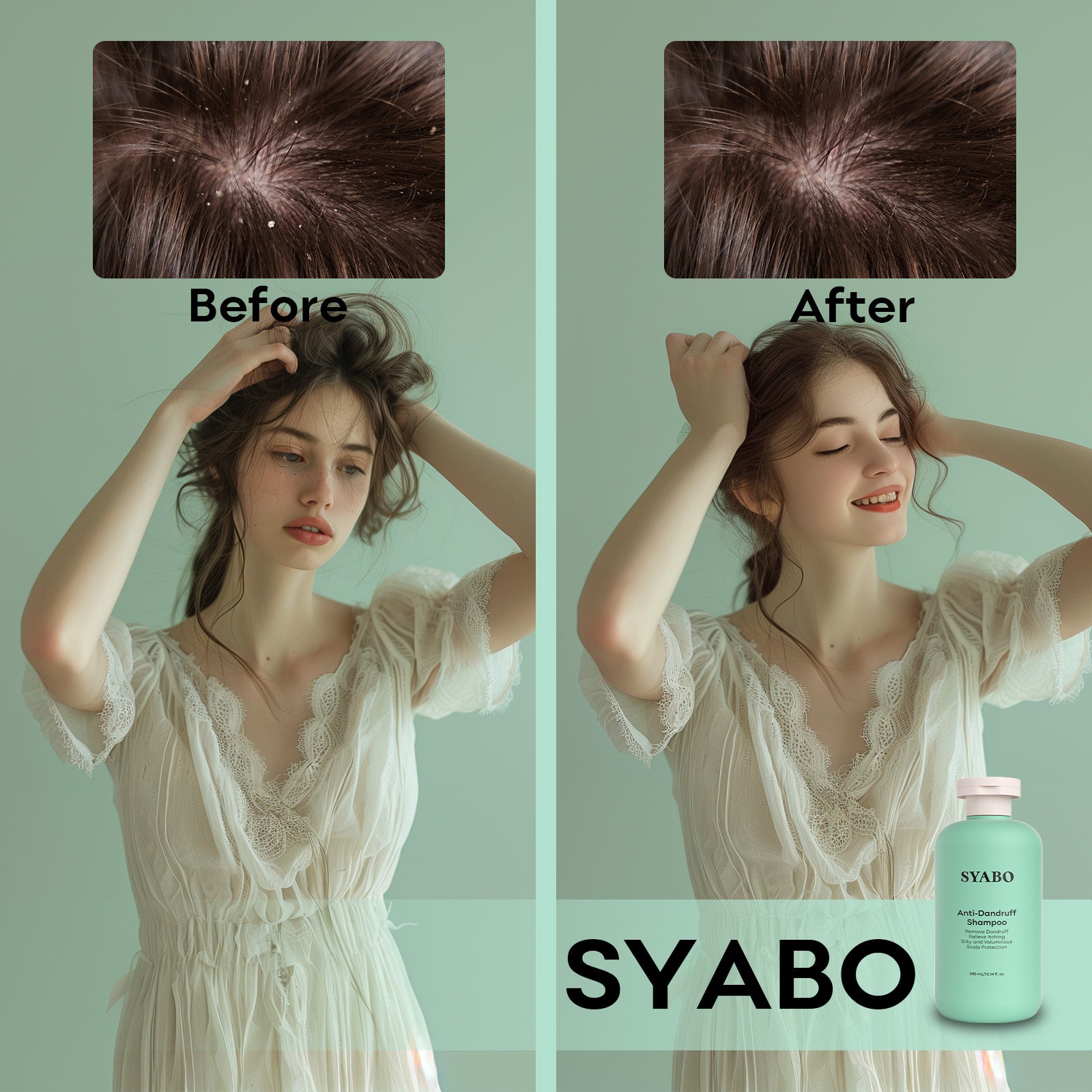 SYABO Anti Dandruff Shampoo for Flaky, Dry, Itchy Scalp, Remove Dandruff and Itching, Soft and Fluffy, Scalp Care and Protect Scalp 10.14 Fl Oz